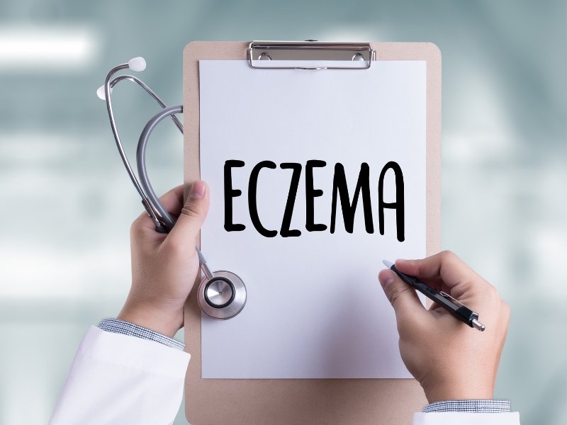 Mon expérience de maman face à l'eczéma de mes enfants - OlieNeela